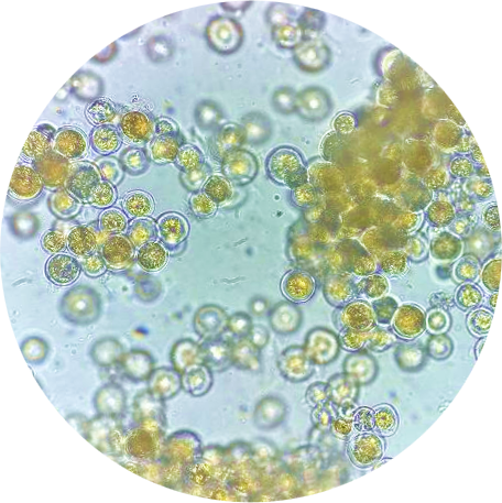 AccessFlora microalgae cells under a microscope, golden with stored DHA oil and carotenoids